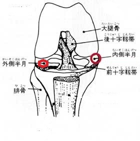 ヘルスケア 半月板損傷は自然治癒が決め手 自力で治した3つの秘策とは